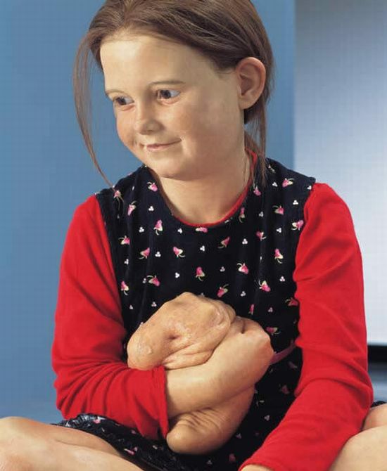 A arte desconcertante de Patricia Piccinini