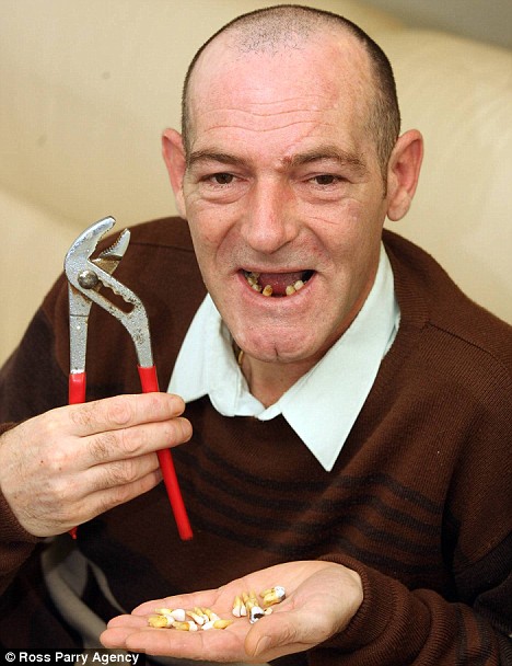 Homem arranca 13 dentes da prpria boca