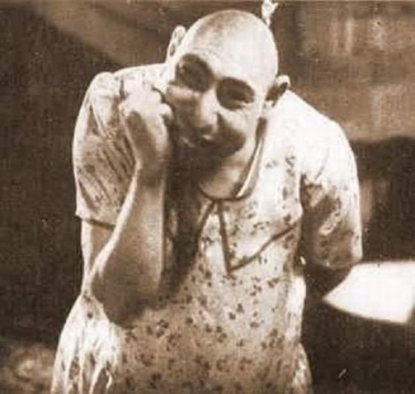 Schlitzie Surtees