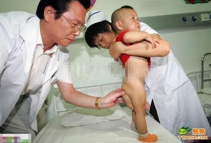 Vítimas da contaminação chinesa?