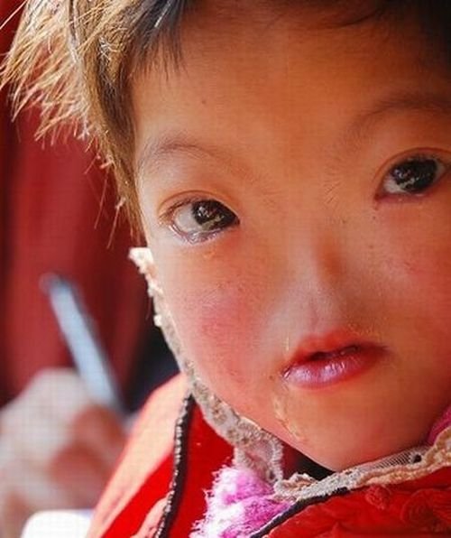 Vítimas da contaminação chinesa?
