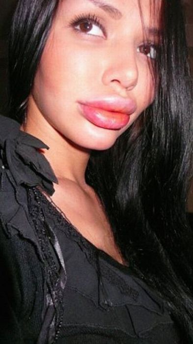 Maria beiuda, outro desastre da cirurgia plstica 11