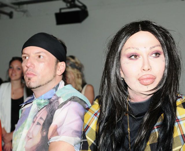 Pete Burns, o rei do silicone