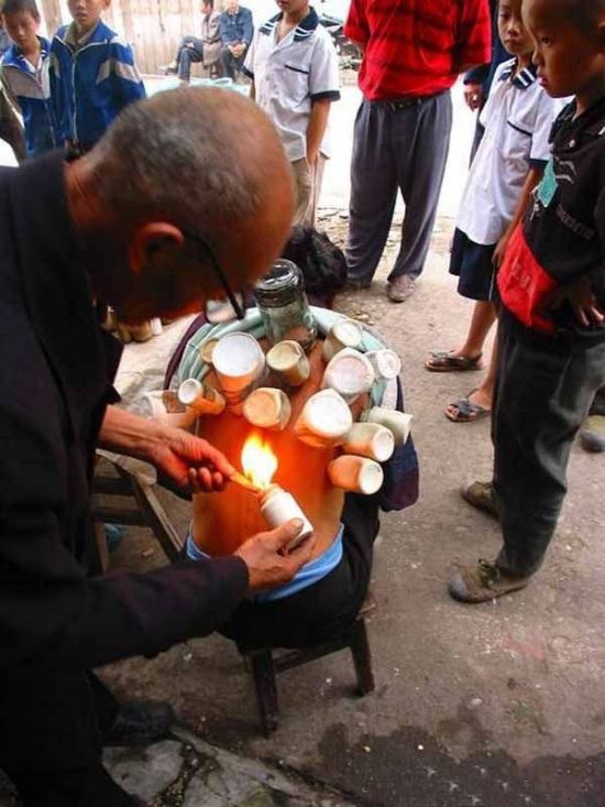 Medicina tradicional de rua na China