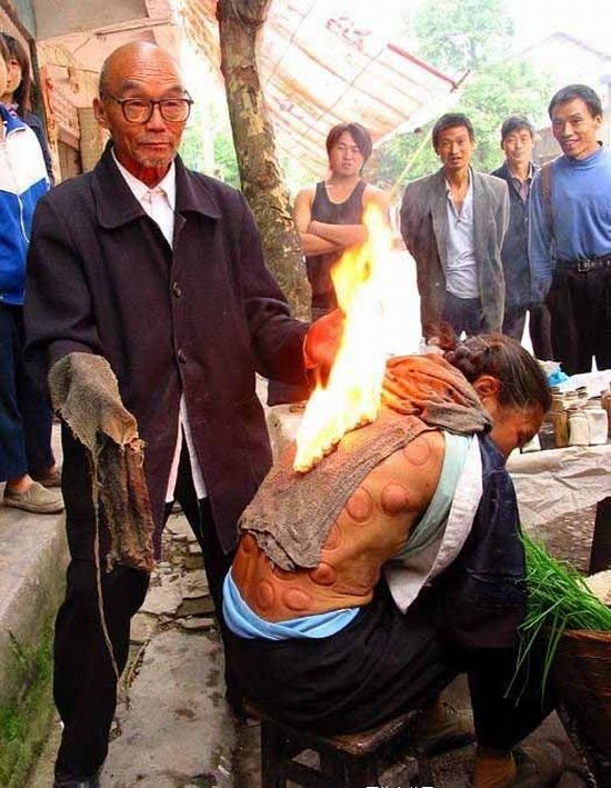 Medicina tradicional de rua na China