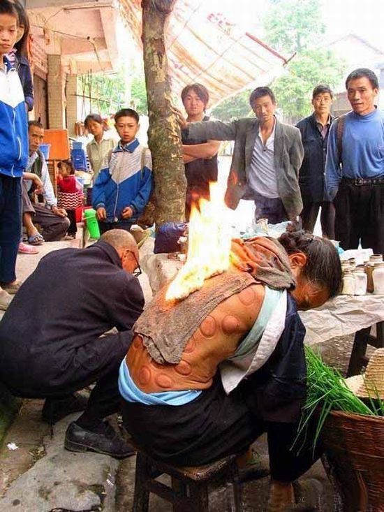 Medicina tradicional de rua na China