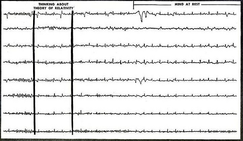 As ondas cerebrais de Albert Einstein