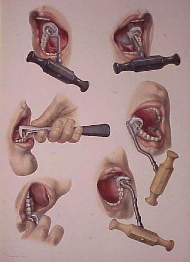 Antigas ferramentas de dentistas