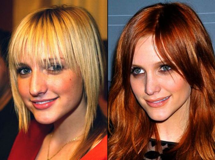 Celebridades antes e depois da cirurgia plástica
