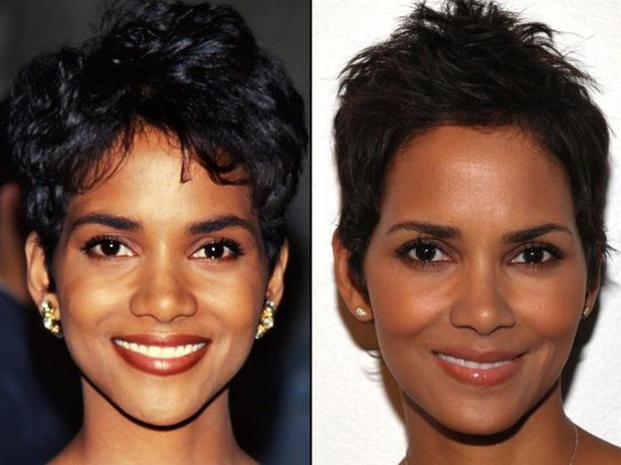 Celebridades antes e depois da cirurgia plástica
