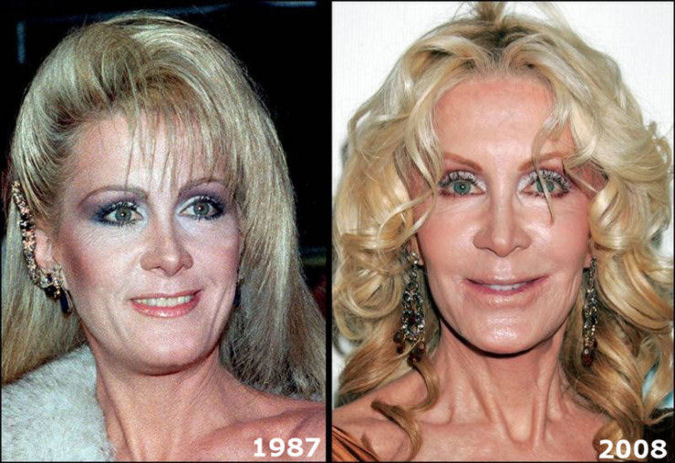 Joan Van Ark, 66 anos de idade.