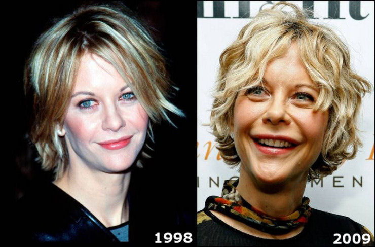 Meg Ryan, 48 anos.