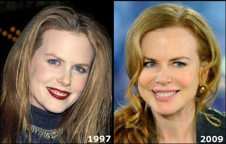 Nicole Kidman, 42 anos.