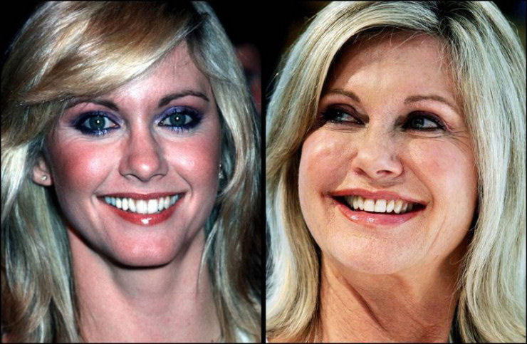 Olivia Newton-John, 61.