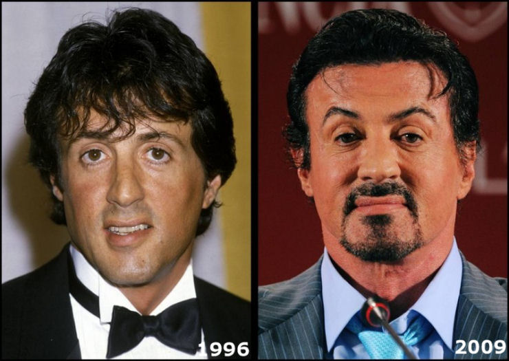 Sylvester Stallone.