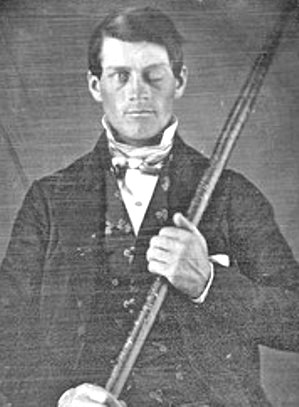 Phineas Gage - O homem que levou ferro