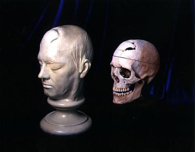 Phineas Gage - O homem que levou ferro