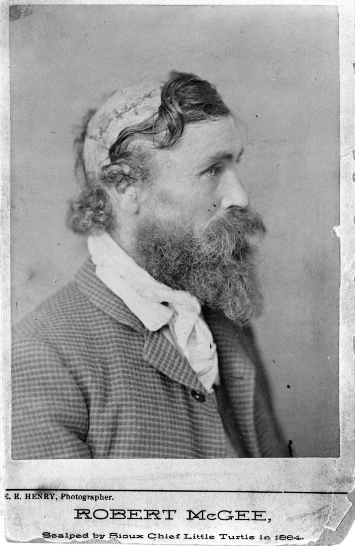 Robert McGee, o homem escalpelado