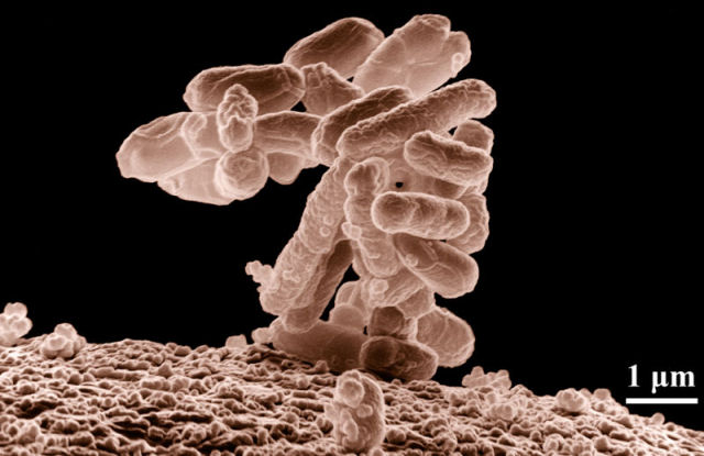 Bactria E.coli