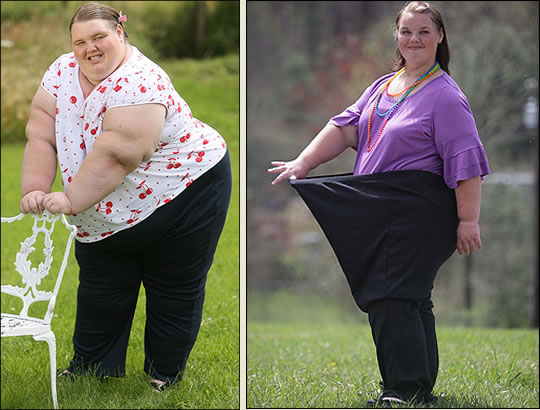 A adolescente mais gorda do mundo perdeu 80 quilos