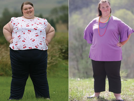 A adolescente mais gorda do mundo perdeu 80 quilos